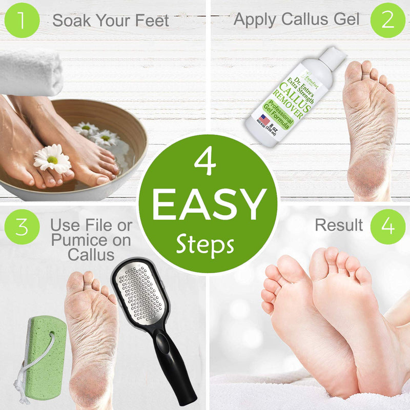 [Australia] - Dr. Entre's Callus Remover Kit for Feet: 8oz Callus Remover Gel, Foot File, Pumice Stone, 5 Glove Pairs for Gel Application, Spa Kit, Foot Care, Pedicure Tools, Scrubber 