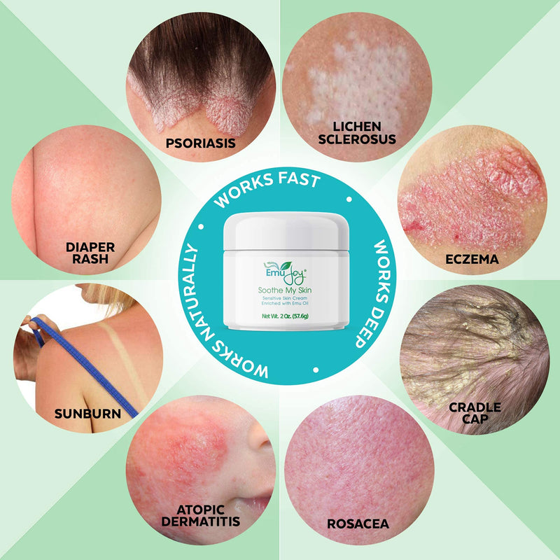 [Australia] - Soothe My Skin Cream for Sensitive Skin - Eczema Cream Psoriasis Atopic Dermatitis Lichen Sclerosus. Emu Oil Cream with Only Natural Ingredients 