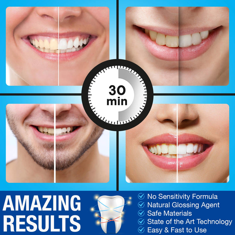 [Australia] - Pro Intellident Teeth Whitening Strips | Home Teeth Whitening Strips Developed by British Dentists for Instant Results 