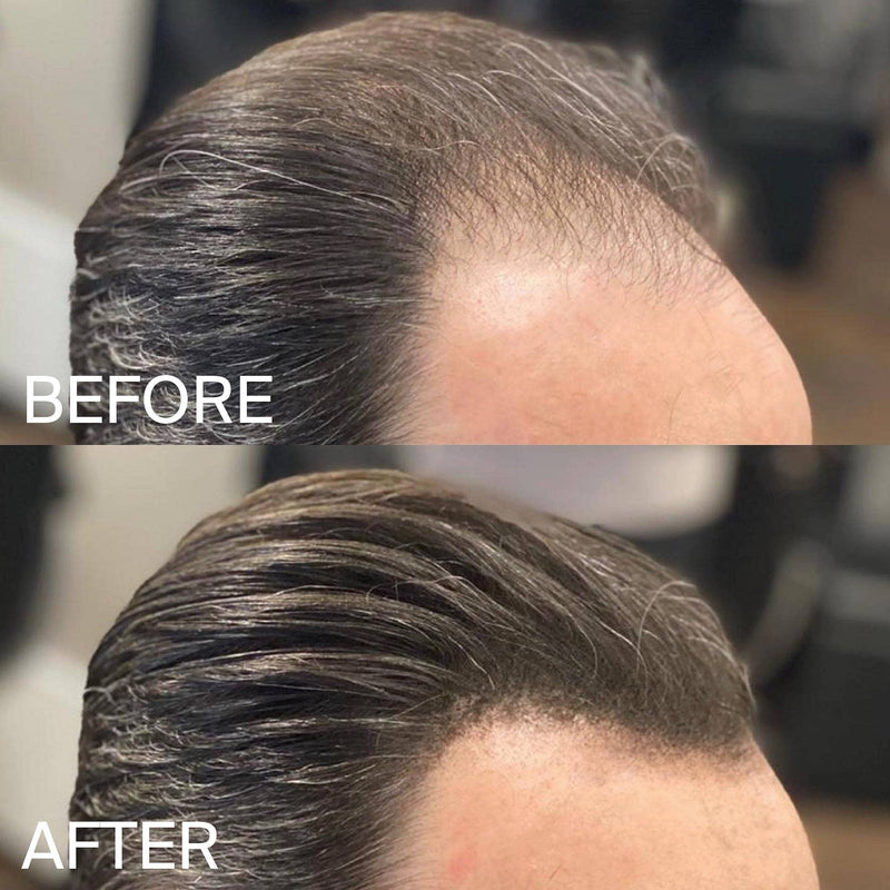 [Australia] - HLS (Hair Loss Solutions) - Hair Fibres, Instantly Conceals Thinning and Balding Hair. Our HLS Hair Powder is Undetectable and is an Instant Hair Thickener, Hair Fibers 25g (Auburn) Auburn 