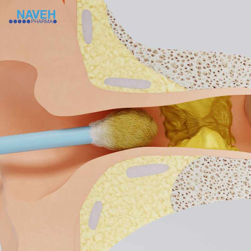 [Australia] - NAVEH PHARMA Otic Guard Natural Ear Wax Removal Spray – Herbal-Oil Blend for Ear Infections and Ear Pain in Adults – Ear Wax Softener for Clogged Ear Relief and Swimmer’s Ear 1 Fl Oz 1 Ounce (Pack of 1) 