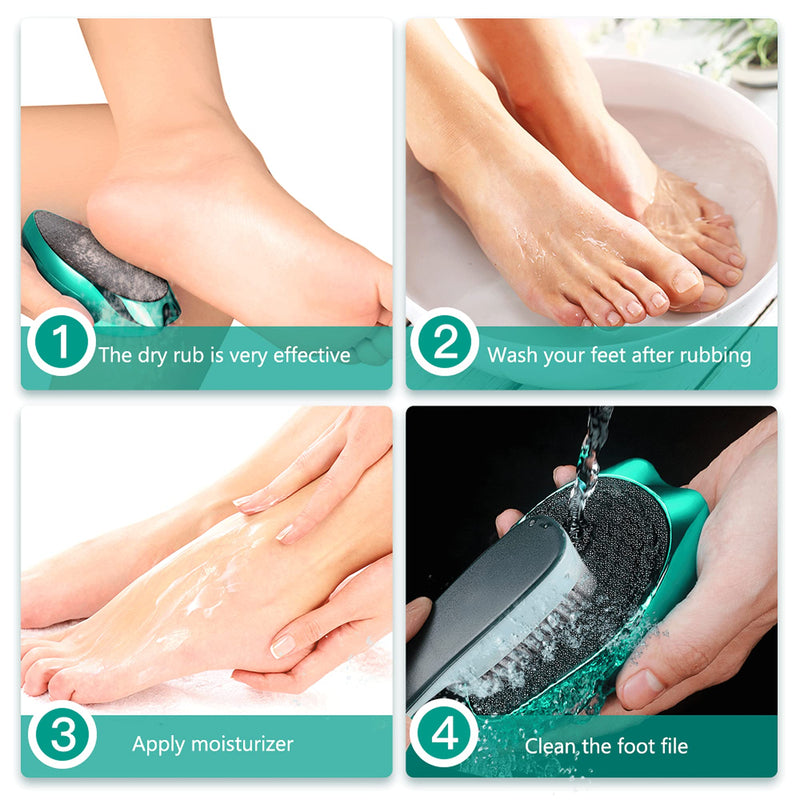 [Australia] - Foot Scrubber Callus Remover File : Fotwen Pedicure Tool Nano Foot Rasp | Professional Foot Care for Hard Skin, Cracking, Wet and Dry Feet (Fotwen x IPQXE) 