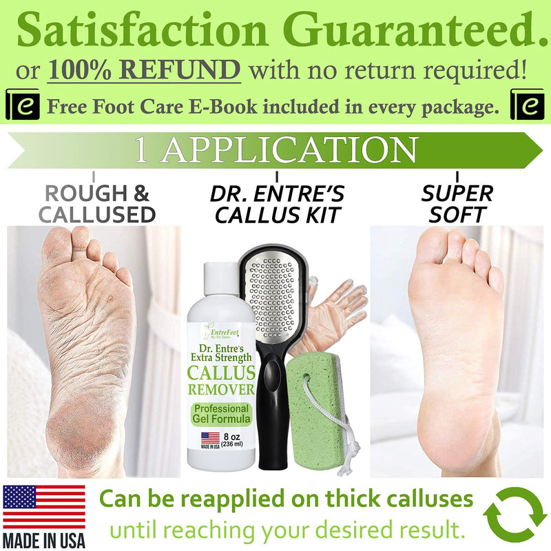 [Australia] - Dr. Entre's Callus Remover Kit for Feet: 8oz Callus Remover Gel, Foot File, Pumice Stone, 5 Glove Pairs for Gel Application, Spa Kit, Foot Care, Pedicure Tools, Scrubber 