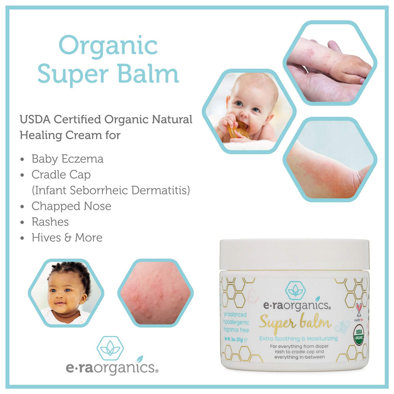 [Australia] - Era Organics Healing Ointment for Babies - USDA Certified Organic Natural Gentle Moisturizer for Sensitive Skin Prone To Baby Eczema, Cradle Cap (Infant Seborrheic Dermatitis), Rashes & Hives (4 oz.) 