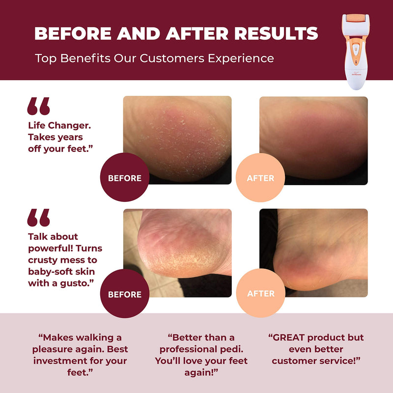 [Australia] - Own Harmony Professional Foot Care for Women: Rechargeable Callus Remover for Feet Electric Foot Sander - Electronic Foot File CR900 with 3 Rollers, Foot Grinder Pedi for Cracked Heels & Hard Skin Peach 