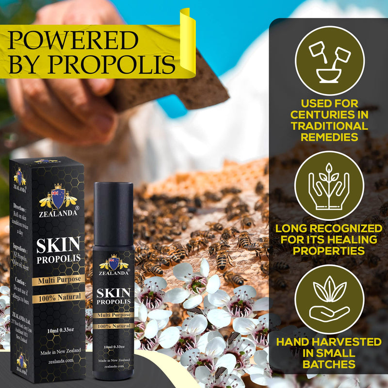 [Australia] - ZEALANDA Skin Propolis, Multi Purpose 100% Natural No Alcohol Treatment for Acne, Pimple, Eczema, Callus, Sunspot ,Skin Rash, Insect Bites, Cuts & Wounds. Made & Packed in New Zealand 