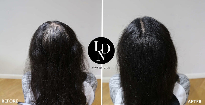 [Australia] - LDN Professional Hair Building Fibres - No1. Hair Fibres for Hair Loss and Thin Hair, Instantly Thicken Hair Naturally, 22g hair fiber bottle (Black) Black 