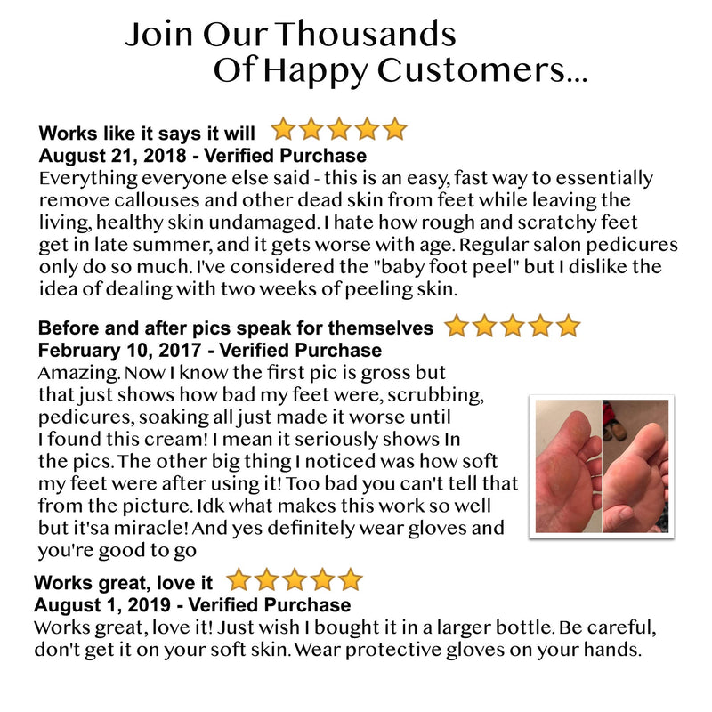 [Australia] - 8oz Callus Remover Gel and Foot File/Foot Rasp Spa Kit. Professional Foot Care for dry, cracked heels. Soak in foot spa then apply callus gel to feet, and use foot scraper to peel off dead skin. 
