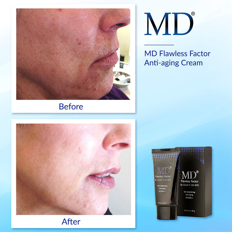 [Australia] - MD Flawless Factor BB Cream for coverage, Skin Brightening & Anti-aging | Anti Wrinkle Cream Moisturizer with Sun Protection | Rated SPF 35 | Suitable For All Skin Types - 1.76 Fl Oz 