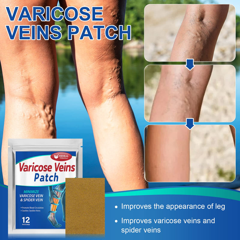 [Australia] - Memonotry Varicose Veins Treatment for Legs, Varicose Veins Patches, Relief Phlebitis Angiitis Inflammation, Improve Blood Circulation for Strengthen Capillary Health, Brown 12 