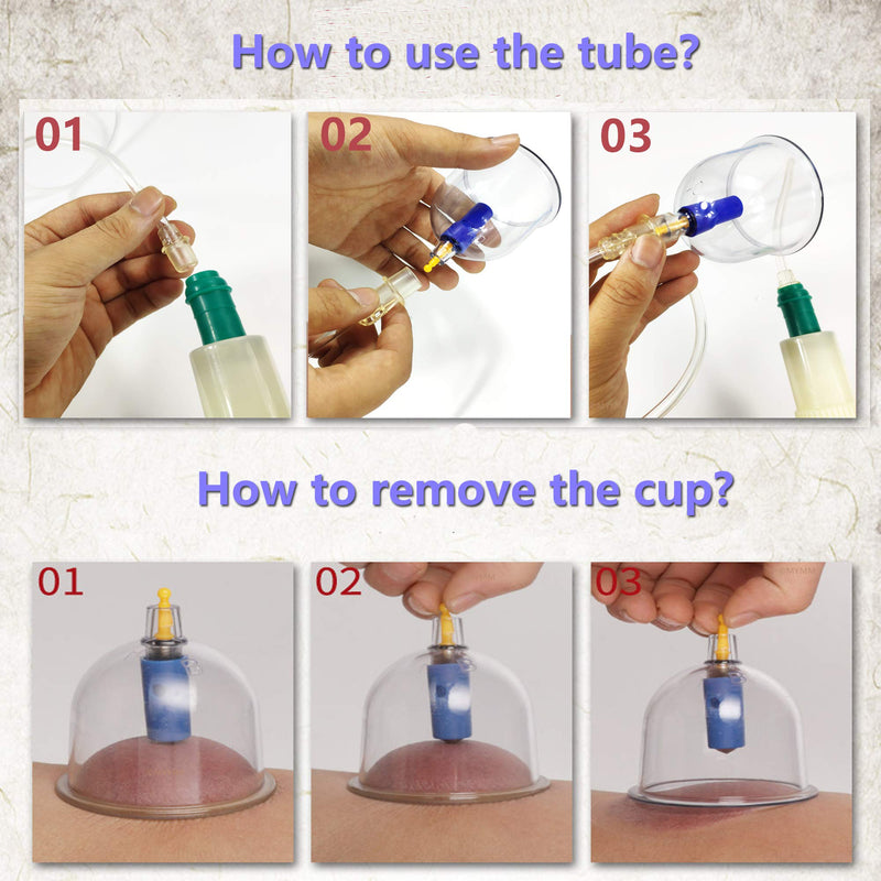 [Australia] - 12 Cupping Cups Sets Biomagnetic Traditional Professional Chinese Therapy Massage Cupping Set Household Pull Out Vacuum Cupping Kit/Chinese Massage Hijama Suction (12) 12 