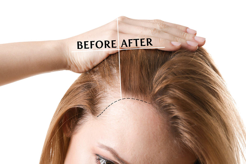 [Australia] - Clearly GAIN, Hair Growth and Thickening Scalp Treatment for Men and Women | 100% Natural Serum with Castor, Jojoba, Clary Sage, Nettle Extract Oils | For Hair Loss, Alopecia, Thinning Hair 60 ml (Pack of 1) 