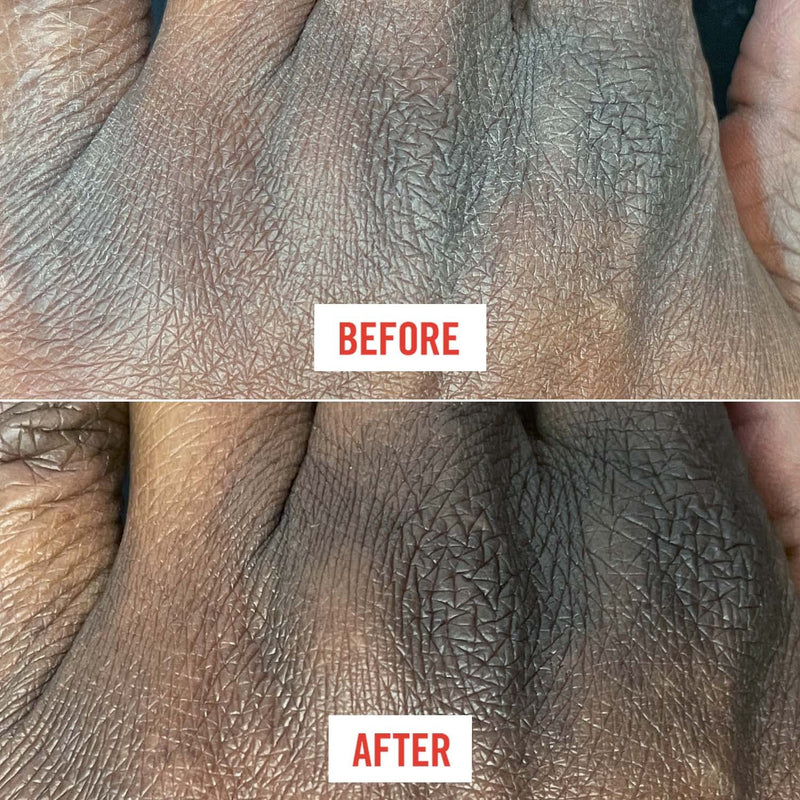 [Australia] - First Aid Beauty Ultra Repair Cream Intense Hydration Moisturizer for Face and Body – 6 oz. 