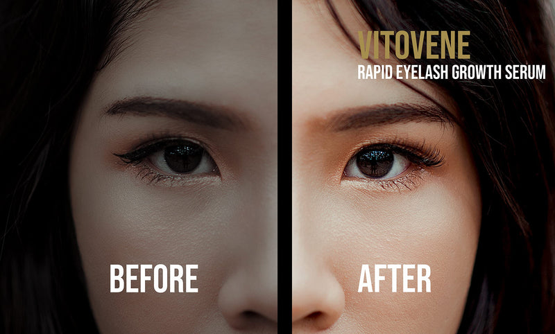 [Australia] - Rapid Eyelash Growth Serum BOOSTER (5ml) | Growth Serum | IT REALLY WORKS | Grow Thicker Natural Longer Stronger Eyelashes | Hypoallergenic & Dermatologist Approved | Concentrated Formula 2022 Winner 