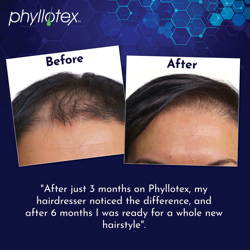 [Australia] - Hair Growth Vitamins for Women and Men by Phyllotex | Scientifically Proven Hair Vitamins for Hair Loss, Hair Shedding and Thinning Hair | Drug-Free, Vegetarian Hair Supplement | 1 Month Supply Pack of 1 