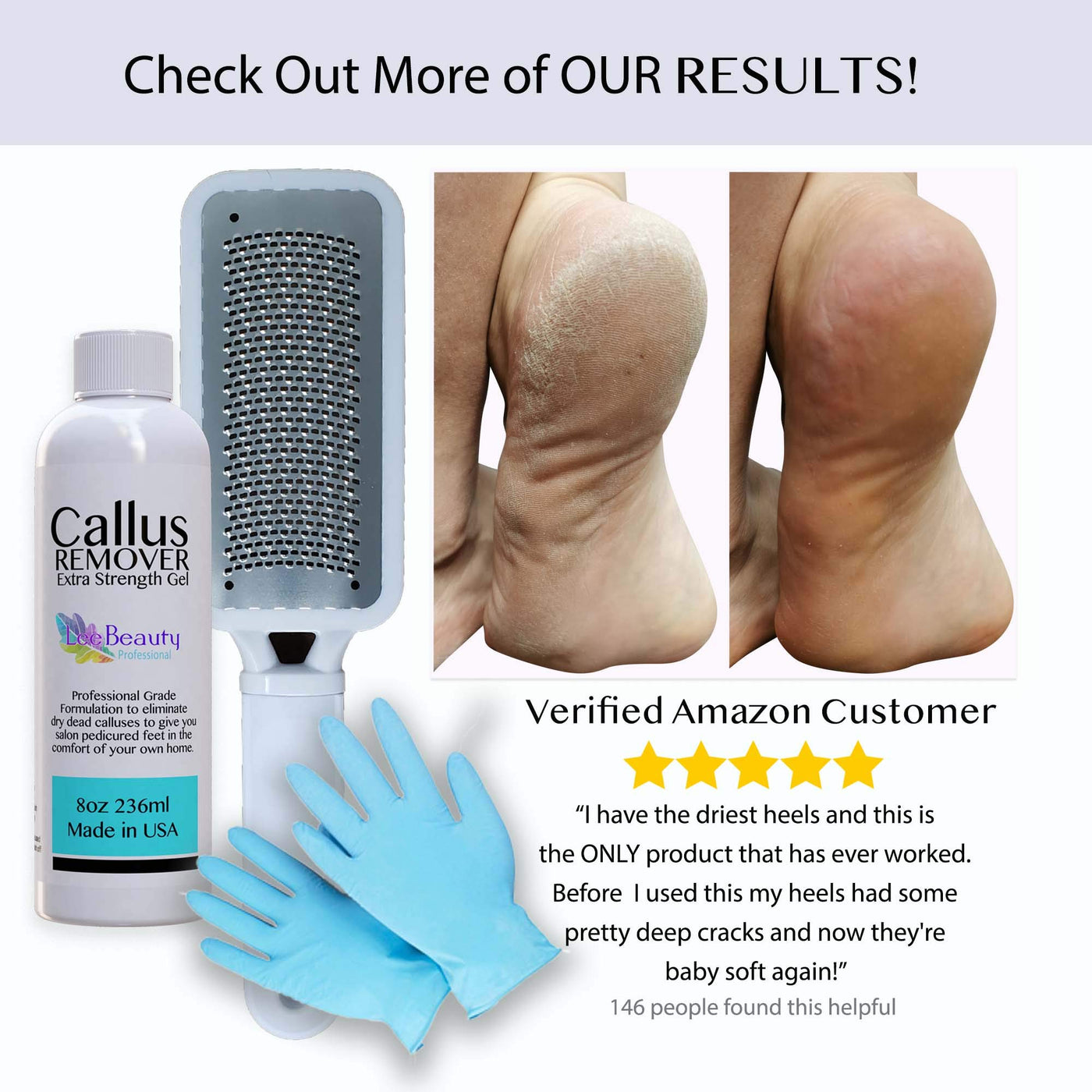 Feet Callus Remover Gel, 12 Packs 8.4 oz with Pumice Stone Scrubber Kit for  Professional Pedicure Remove Hard Skins Heels Callouses, Orange Scent