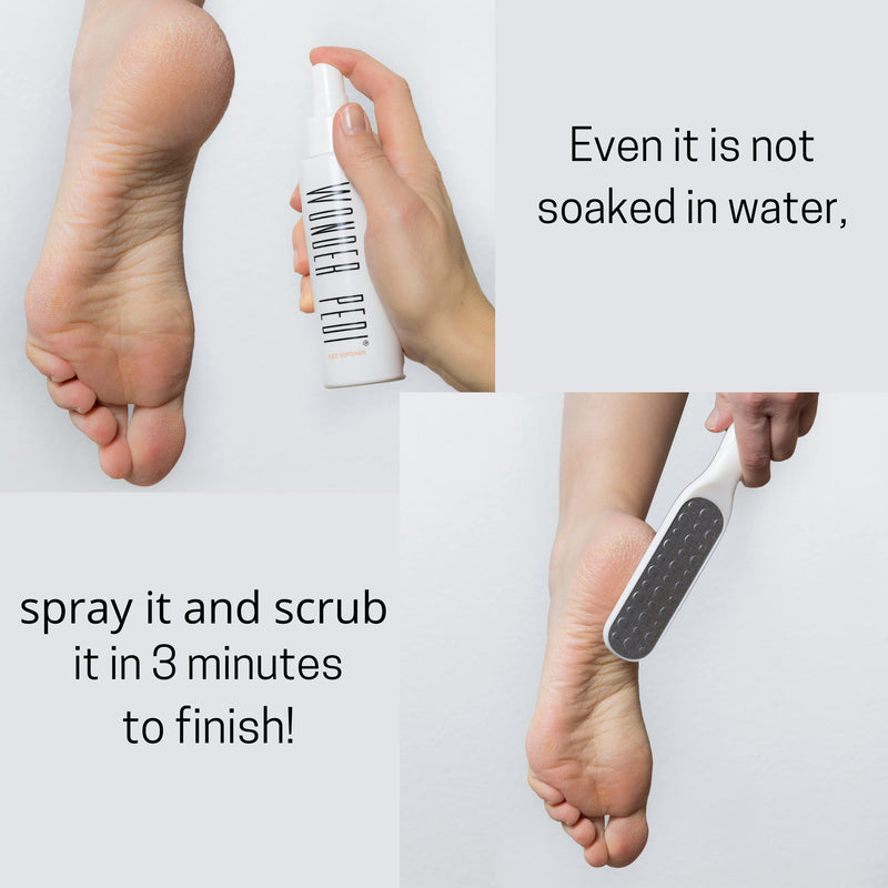 [Australia] - Callus Remover Instant Exfoliating Softener Peel Spray for Feet - Double Sided Foot File - Heels Callus Scrubber – Home Spa Pedicure Treatment. Wonder Pedi (Foot File + Softener) Foot File + Softener 