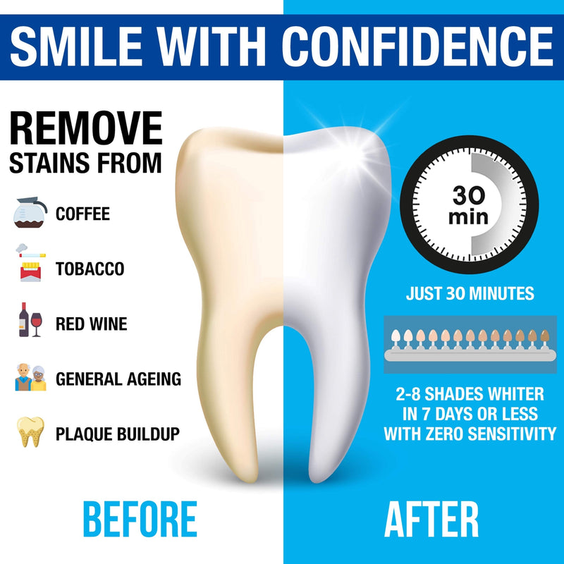 [Australia] - Pro Intellident Teeth Whitening Strips | Home Teeth Whitening Strips Developed by British Dentists for Instant Results 