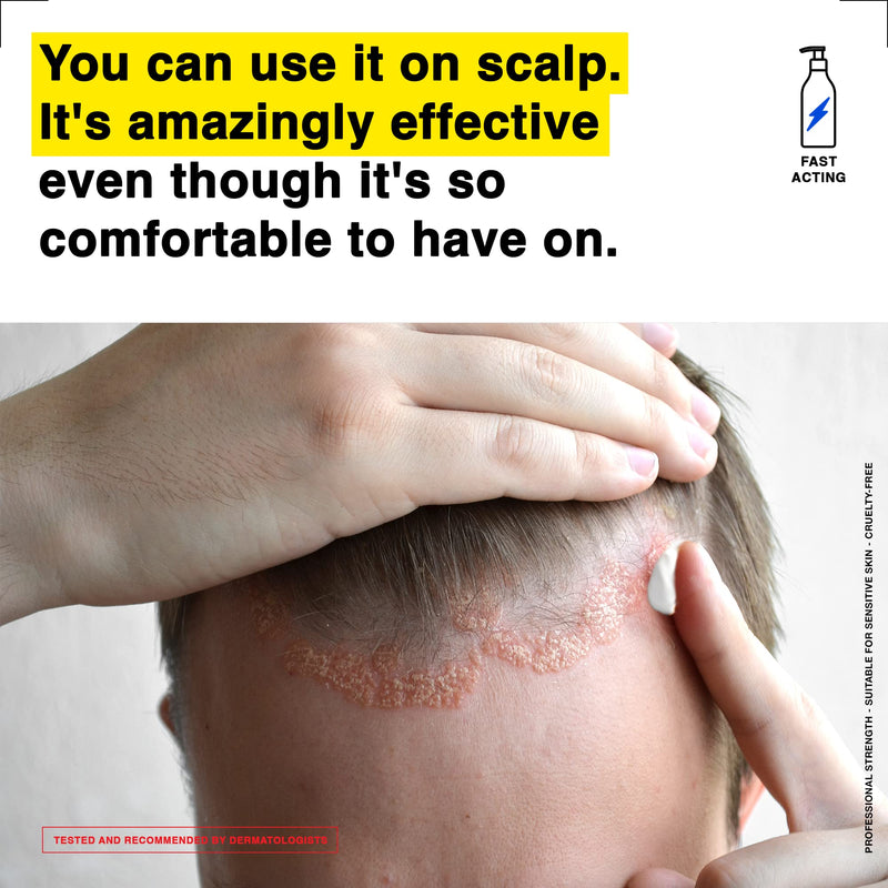 [Australia] - Healpsorin Emollient Balm: Itch Relief Cream Helps Repair Skin Barrier and Treat Conditions Such as Eczema, Psoriasis & Dermatitis - Rash Cream Calms Dryness & Scaling Without Inflaming Sensitive Skin 