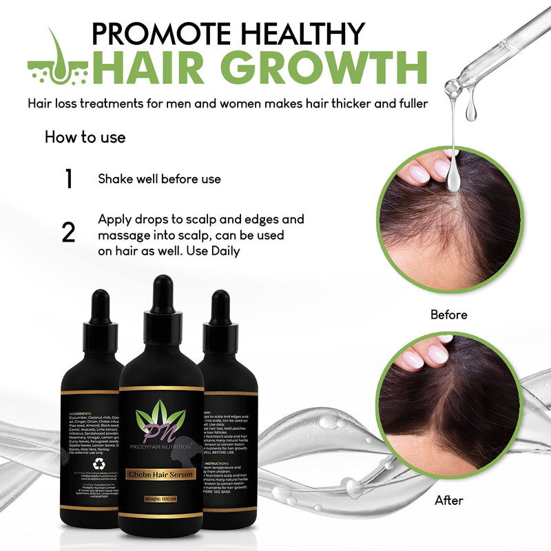 [Australia] - Priddyfair Nutrition Chebe Hair Growth Serum 100ml contains Biotin rich Fruits & Herbs for Anti Hair Loss, Hair Serum Growth Treatment Oil, Thinning Hair | Help Hair Follicle Growth For Men & Women 