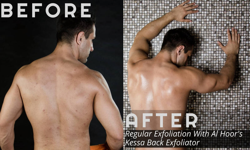 [Australia] - Moroccan Kessa Back Scrubber Exfoliator - Premium Quality Exfoliating Strap For Dead Skin, Acne, Ingrown Hair, And Fake Tan Removal 