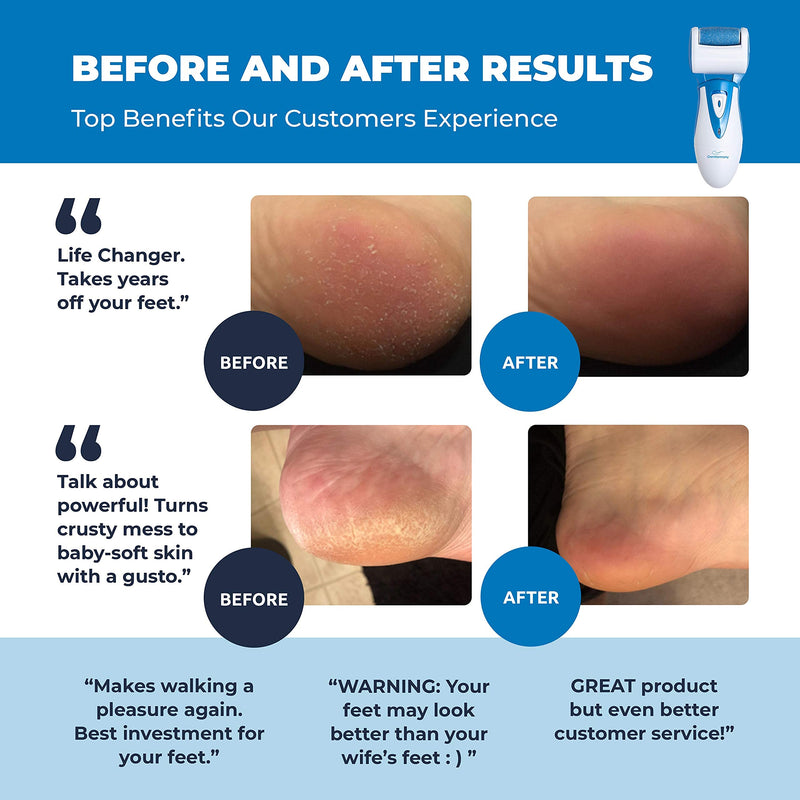 [Australia] - Electric Callus Remover: Own Harmony Professional Pedicure Tools Foot Care for Women, Rechargeable Foot Scrubber, CR900 Electronic Feet File Pedi Sander Best for Hard Cracked Dry Dead Skin, 3 Rollers Blue 