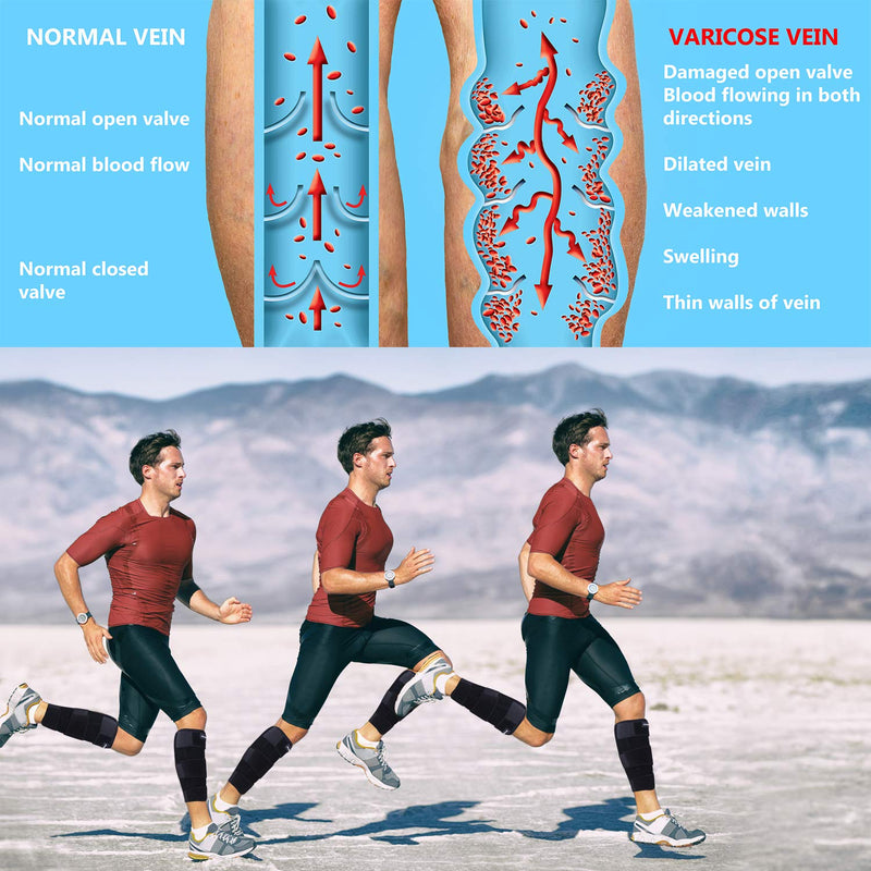 [Australia] - 2U2O Calf Brace - Adjustable Shin Splint Compression Support for Calf Pain Relief, Recovery, Sprain, Swelling, Tennis Leg, - Lower Leg Wrap - Calf Sleeve for Men or Women - Universal Size 2Packs 