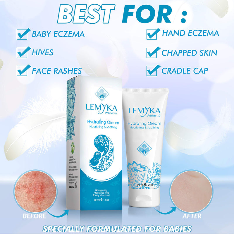 [Australia] - Eczema Cream for Baby, organic Itch relief therapy for dry skin, infant rash, atopic dermatitis, Hives, LEMYKA Soothing balm 