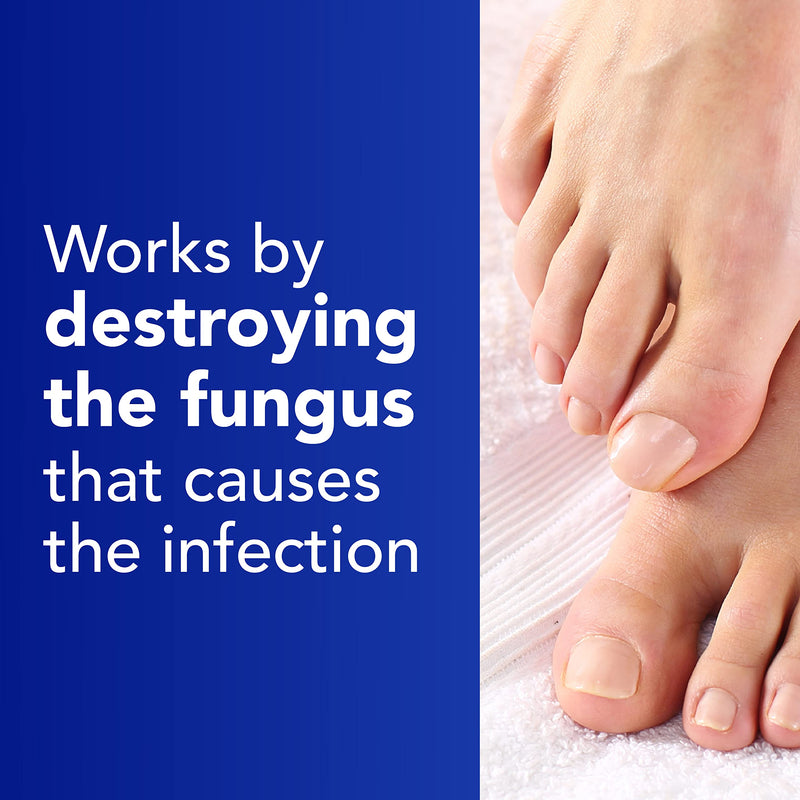 [Australia] - Daktarin Aktiv Cream – Help Treat Your Athlete's Foot - Athlete's Foot Cream - Foot Care - 30 g 