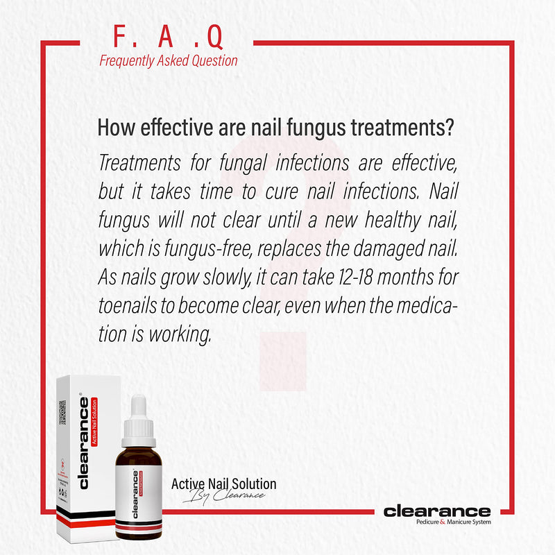 [Australia] - Clearance Active Nail Solution 30ml Fast Relief for Irritations, Fungal Infections, and Onycholysis with Essential Oils and Plant Extracts 