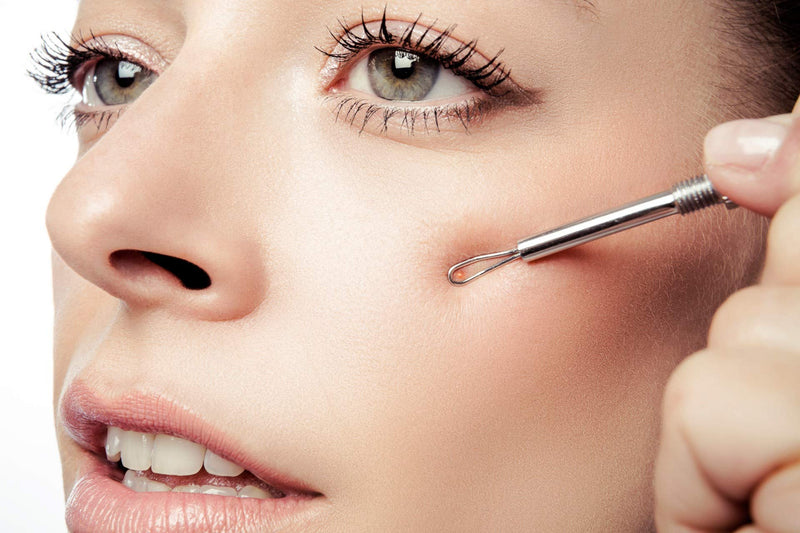 [Australia] - Remos Blackhead and comedone Acne Extractor with fine Gouge, Stainless, 11.5 cm With gouge and loop 