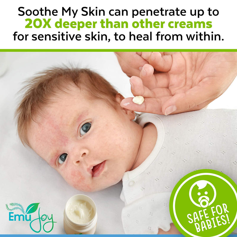 [Australia] - Soothe My Skin Cream for Sensitive Skin - Eczema Cream Psoriasis Atopic Dermatitis Lichen Sclerosus. Emu Oil Cream with Only Natural Ingredients 
