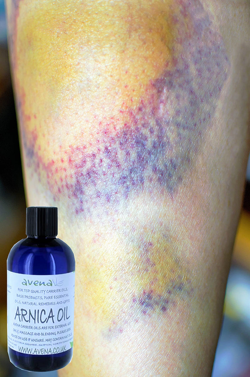 [Australia] - Arnica Bruise Cream Arnica Oil for Bruising Arnica Massage Oil Arnica Massage Balm Made in Yorkshire (250ml Oil) 250ml Oil 