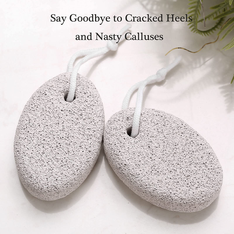 [Australia] - 2PCS Natural Pumice Stone for Feet, HOOMBOOM Lava Pedicure Tools Hard Skin Callus Remover for Men/Women Feet and Hands - Natural Foot File Exfoliation to Remove Dead Skin A&white 
