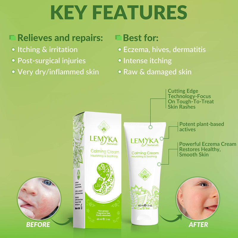 [Australia] - Eczema cream for dry itchy skin, LEMYKA 10X organic plant actives & ceramides for atopic dermatitis, face & eyelid rash, hives - Fast relief for baby, kids and adults 