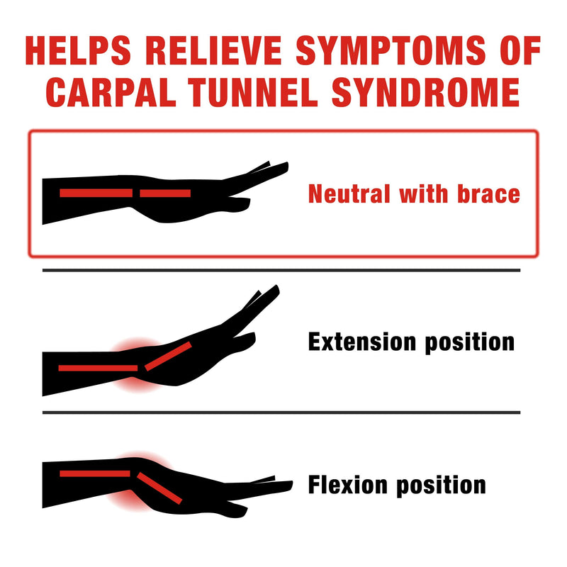 [Australia] - ACE Deluxe Wrist Stabilizer, Right Hand, Helps Relieve Symptoms of Carpal Tunnel Syndrome, Adjustable, Stabilizing, Firm Support 