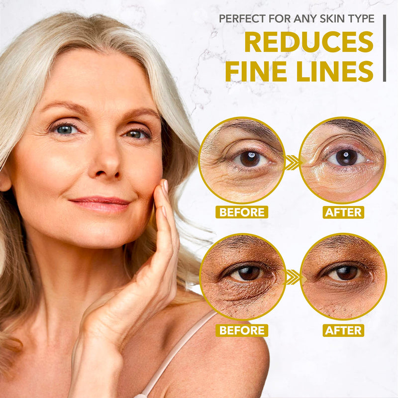 [Australia] - Under Eye Patches - 24K Gold Under Eye Mask for Puffy Eyes, Dark Circles, Eye Bags, Wrinkles, Puffiness with Collagen - Anti Aging Skincare Eye Patch Treatment Masks - Hydrating Under Eye Gel Pads 