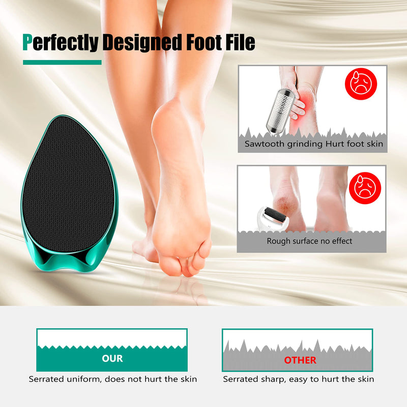 [Australia] - Foot Scrubber Callus Remover File : Fotwen Pedicure Tool Nano Foot Rasp | Professional Foot Care for Hard Skin, Cracking, Wet and Dry Feet (Fotwen x IPQXE) 