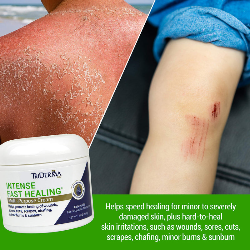 [Australia] - TriDerma Intense Fast Healing Cream, Decreases Healing Time for Minor Irritations, Rashes, Wounds, Cuts, Scrapes, Value Pack of 2 - 4 Ounce Jars 