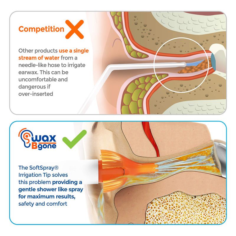 [Australia] - WaxBgone Ear Wax Removal Kit with SoftSpray Ear Irrigation Tips for Safe and Effective Earwax Removal - Complete Ear Cleaning Kit for Adults and Kids - Includes Ear Wax Removal Softening Drops 