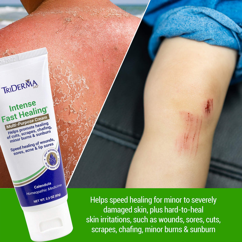 [Australia] - TriDerma Intense Fast Healing Multi-Purpose Cream for Cuts, Scrapes, Sores, Chafing, Minor Burns and Sunburn (2.2 oz Tube) 