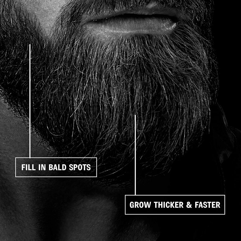 [Australia] - Red-Blooded Beard Growth Roller | 540 0.5MM Titanium Needles | Derma Roller for Men | Matte Black Beard Roller | Stimulate Beard and Hair Growth | Microneedle Roller 