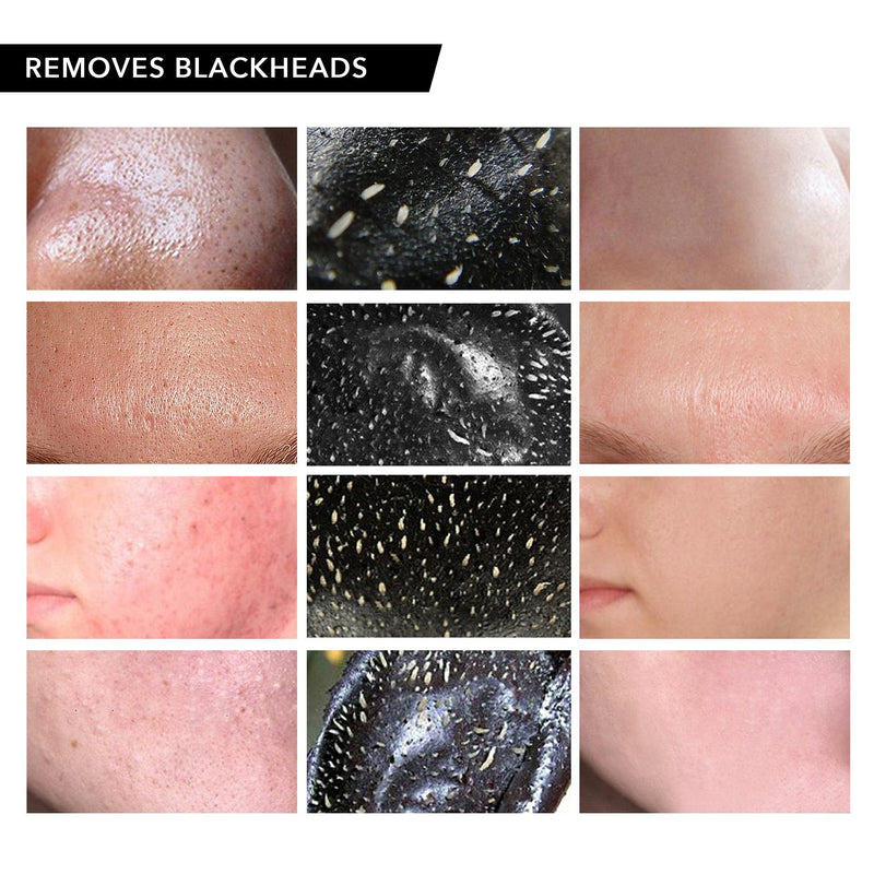 [Australia] - Vassoul Blackhead Remover Mask, Peel Off Blackhead Mask - Deep Cleansing Black Mask, Bamboo Activated Charcoal Peel-Off Mask 