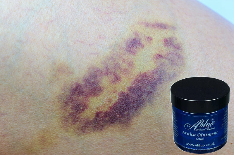 [Australia] - Arnica Bruise Cream Arnica Oil for Bruising Arnica Massage Oil Arnica Massage Balm Made in Yorkshire (250ml Oil) 250ml Oil 