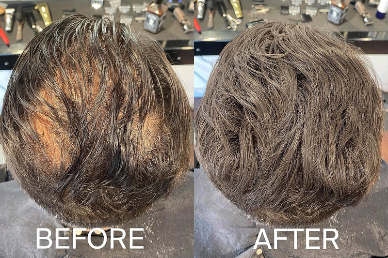 [Australia] - HLS (Hair Loss Solutions) - Hair Fibres, Instantly Conceals Thinning and Balding Hair. Our HLS Hair Powder is Undetectable and is an Instant Hair Thickener, Hair Fibers 25g (Auburn) Auburn 