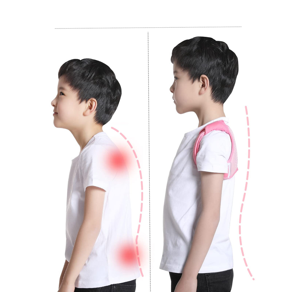 [Australia] - Posture Corrector for Kids Adjustable Breathable Upper Back Support Brace Back Straightener Posture Brace for Clavicle Support and Pain Relief from Back Neck Shoulder (Pink, Medium) Pink 