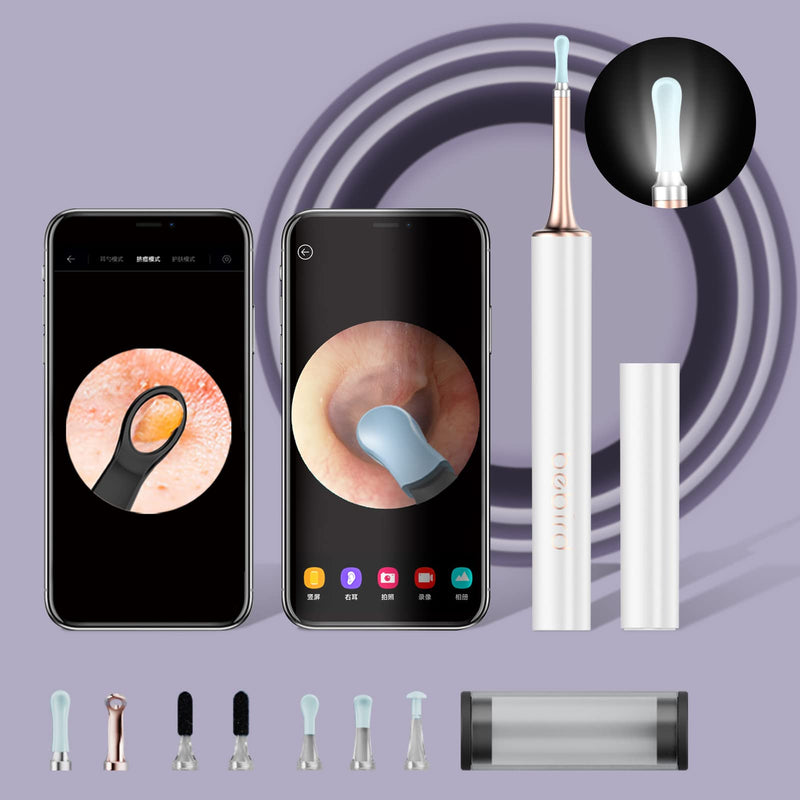 [Australia] - BEBIRD T15 Ear Wax Removal Tool, Ear Cleaner with Camera, Squeeze Acne Tool（Inside The Top Cover Cap), Wireless Otoscope Compatible with iPhone, iPad, Android Phones for Adult & Kids White 
