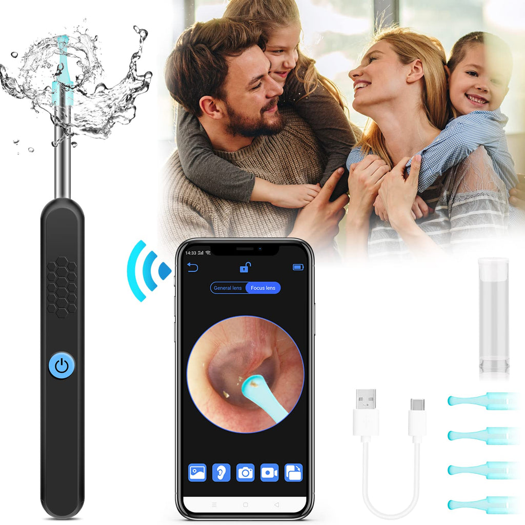 [Australia] - Topicy Ear Wax removel Kit Ear Camera and Wax Remover Ear Light Otoscope 2022 Newest 1296P Wireless Ear Wax Removal Tool Camera for iPhone, iPad, Android Phones, Black 