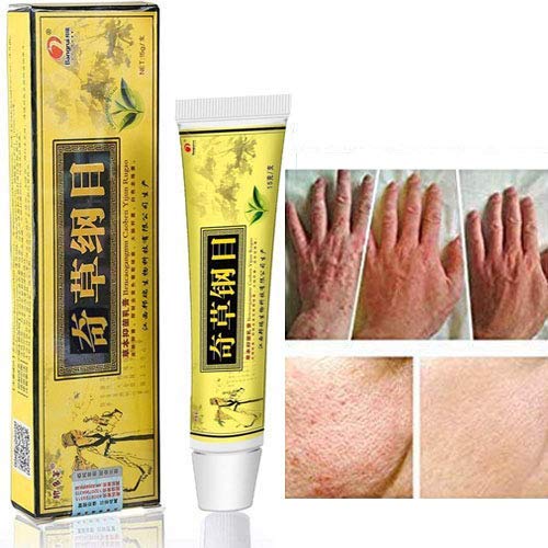 [Australia] - 2pcs Chinese Herbal Eczema, Psoriasis Creams Dermatitis and Eczema Pruritus Psoriasis CEZUBEM Ointment 