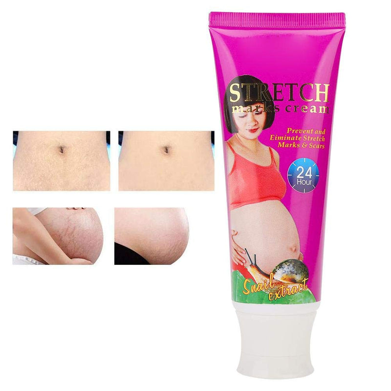[Australia] - Scars Treatment, Anti-Stretch Cream Remove Stretch Marks Oil Stretch Marks Cream for Women Legs, Stomach Scars Removal Harden Cream 